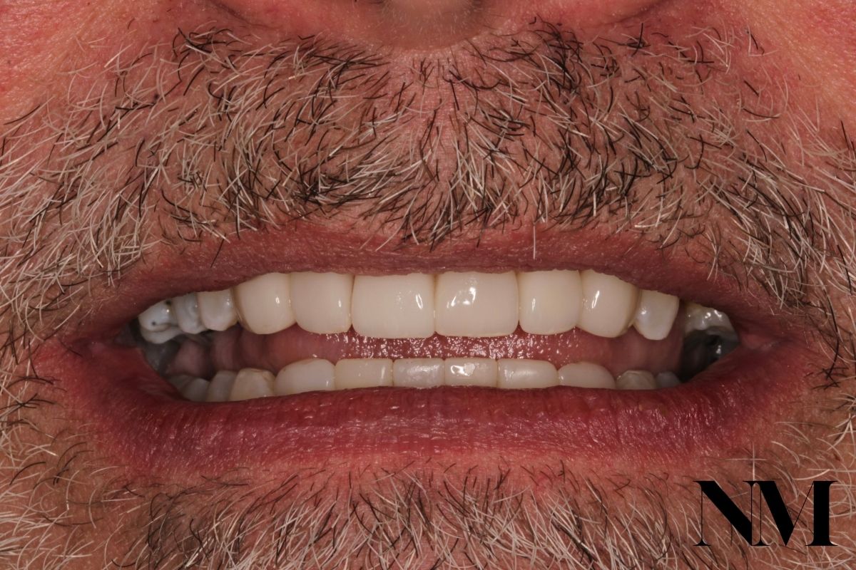 James Price After Logo